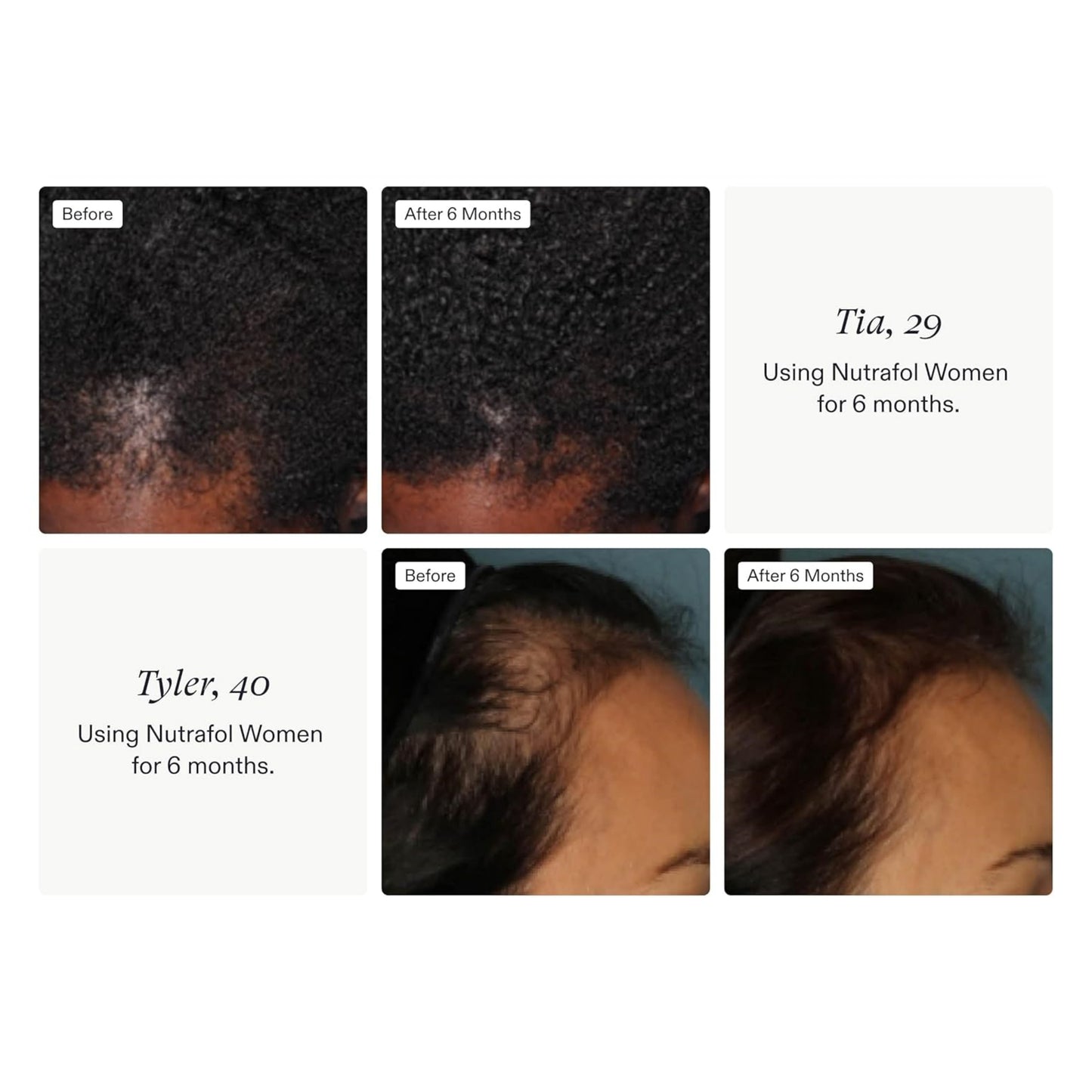 Nutrafol Women's Hair Growth Supplements 1 Month Supply